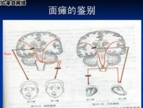 头面部的双侧性支配指的是什么？