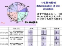 心电图检查发现电轴右偏，应采取哪些措施？