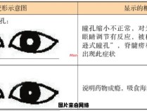 判断瞳孔大小是否正常及异常的方法