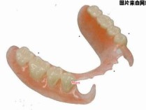 全口假牙的护理与维护方法