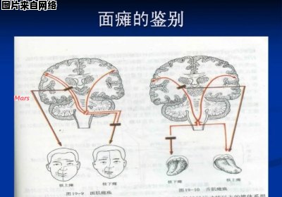 头面部的双侧性支配指的是什么？