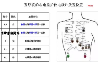 心电监护电极安装位置