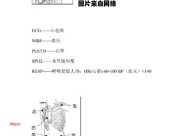 心电监护电极安装位置