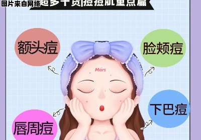 去除痘痘的实用技巧