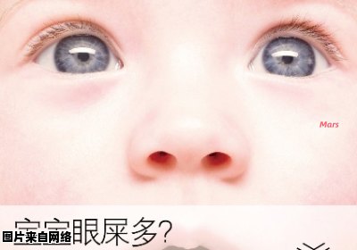宝宝为什么会有那么多眼屎？