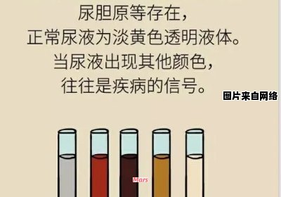 男性尿液中红细胞增高的原因是什么？