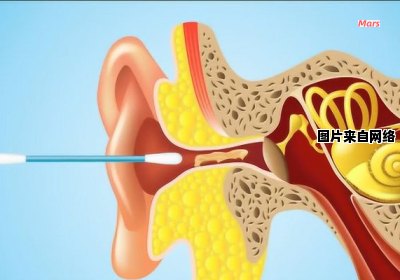 耳道堵塞的治疗方法有哪些？