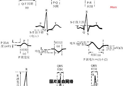 心电图检查发现电轴右偏，应采取哪些措施？