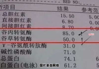 高谷丙转氨酶的治疗方法